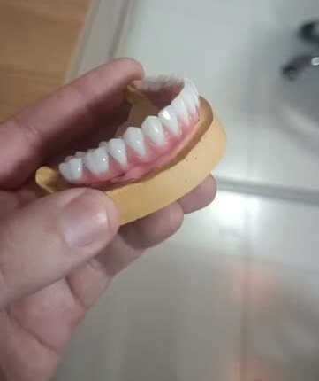 Prótese sobre implantes inferior